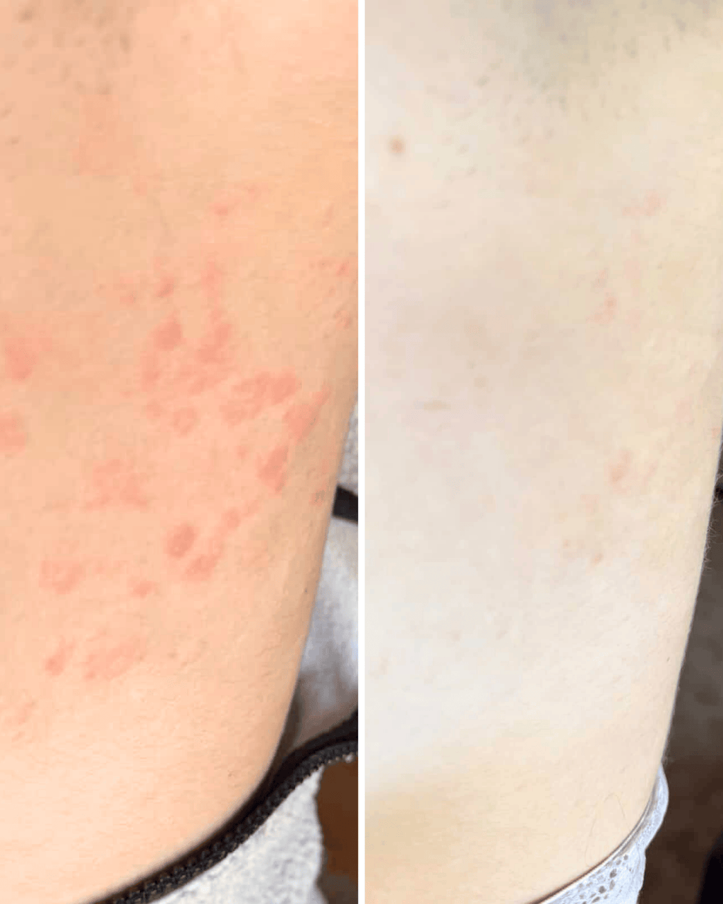 No. 4 - Sensitive Body Skincare Bar
